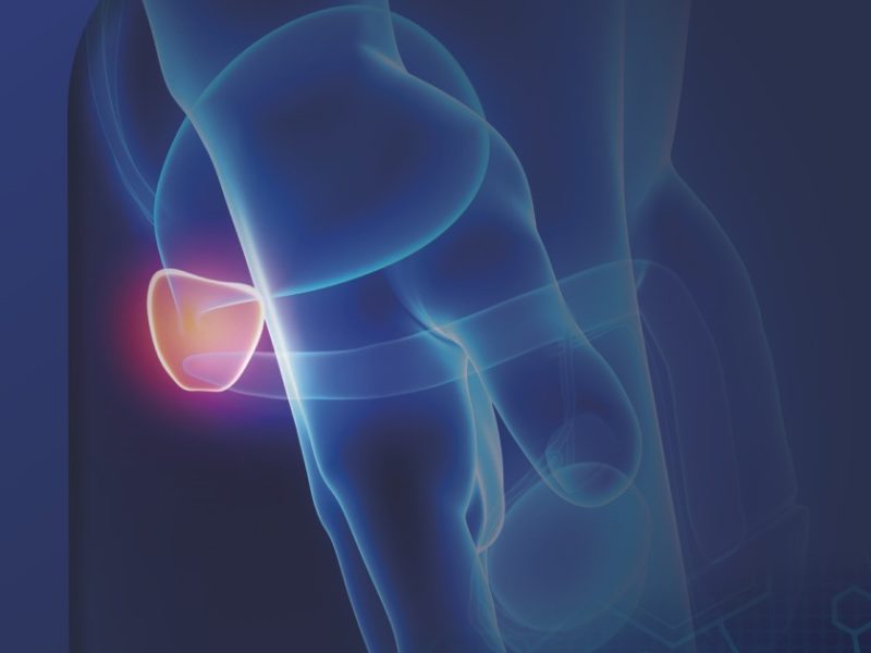 Wozu Urologie? ALLGEMEINE INFOBROSCHÜRE